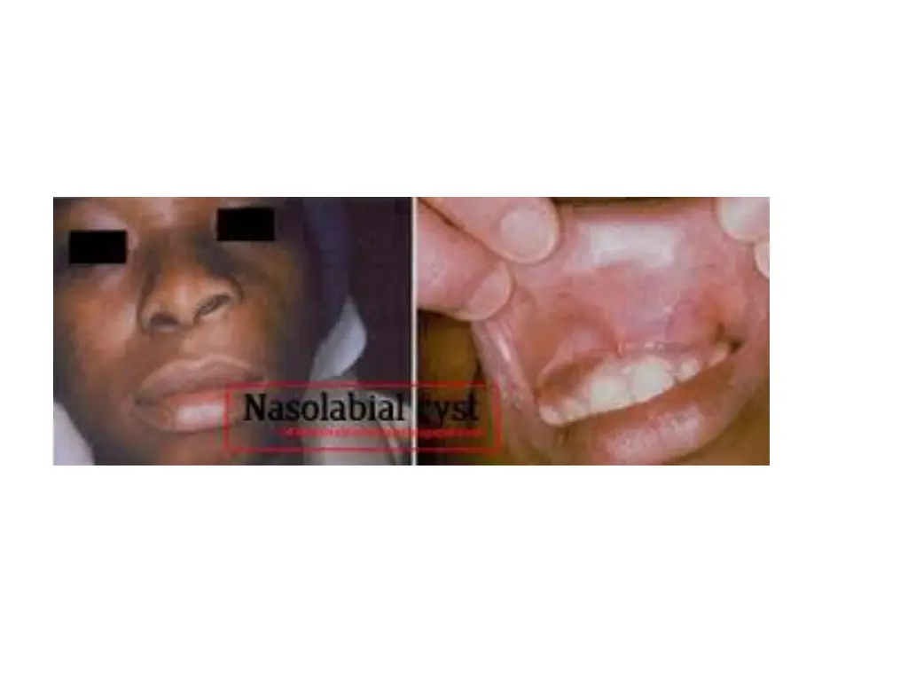 slide49