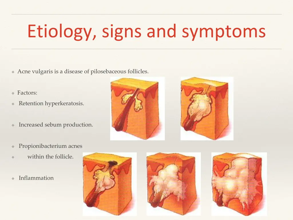 etiology signs and symptoms