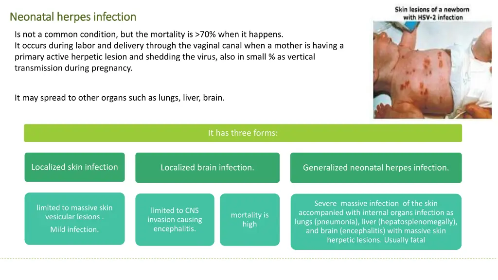 neonatal herpes infection neonatal herpes