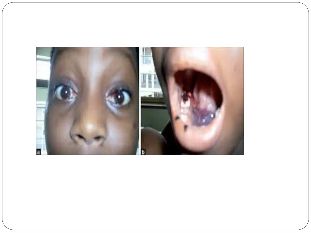 slide13