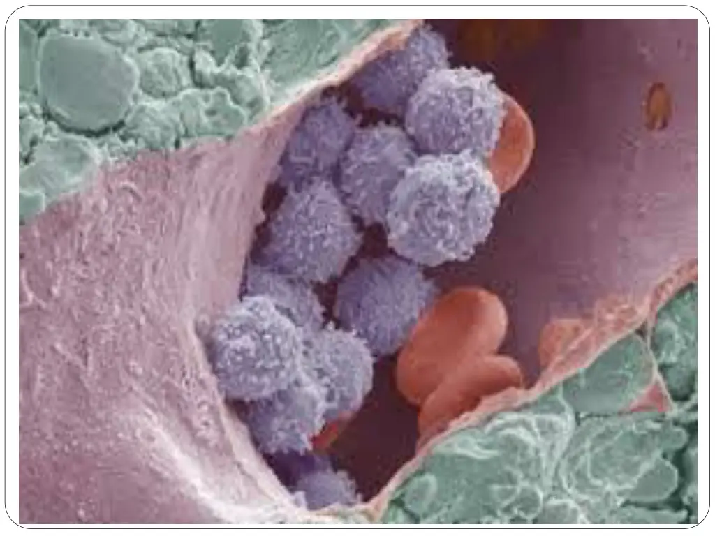 slide20