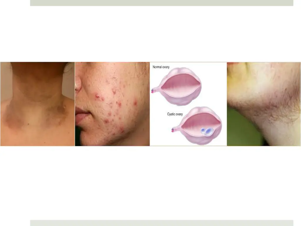 slide9