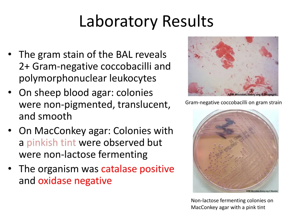 laboratory results