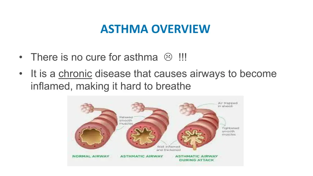 asthma overview 2