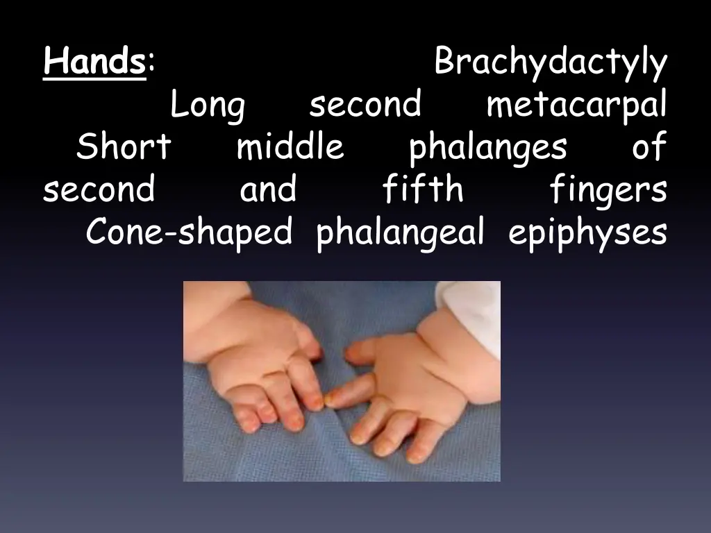 hands