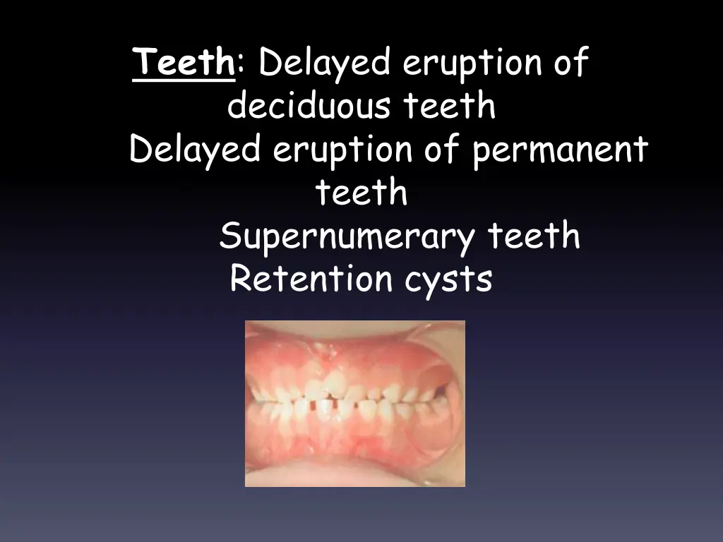 teeth delayed eruption of deciduous teeth delayed