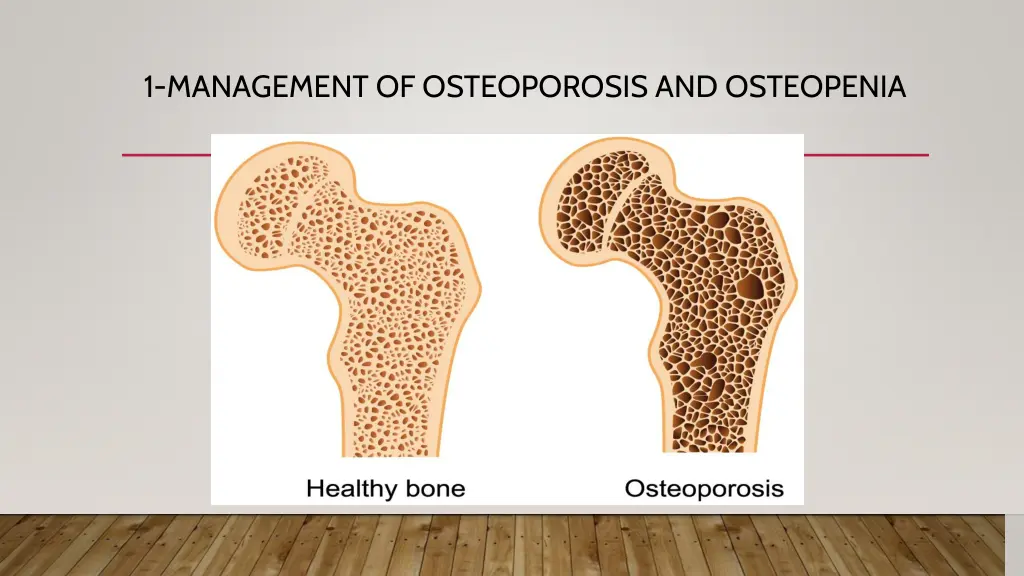 1 management of osteoporosis and osteopenia 1