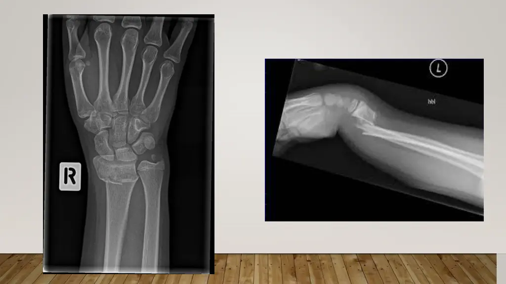 slide21