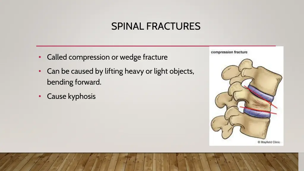 spinal fractures