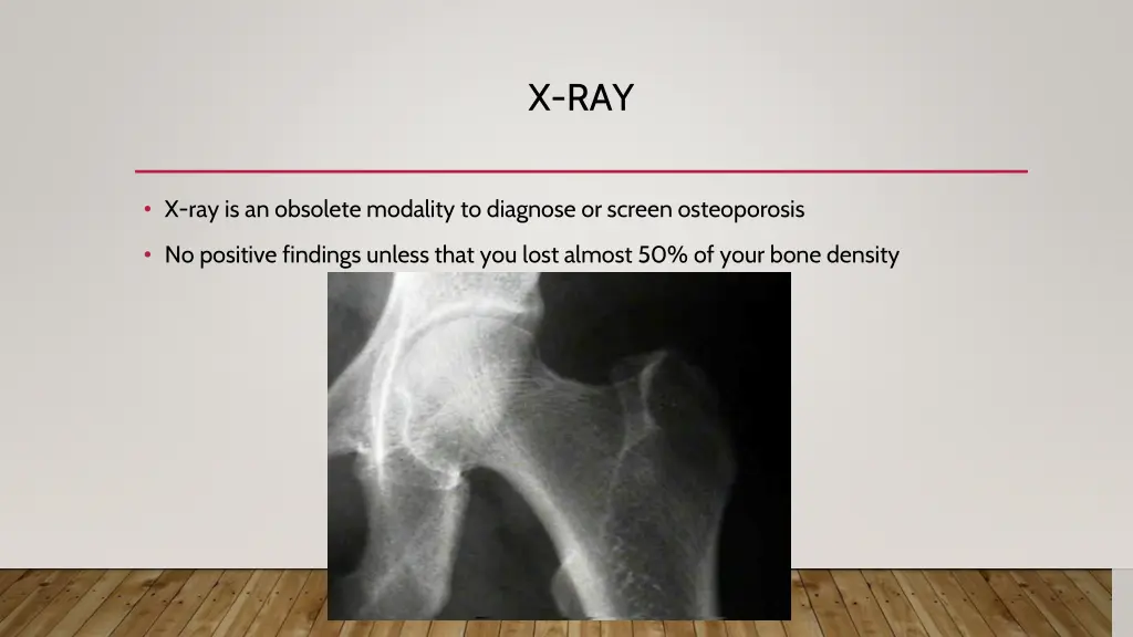 x ray