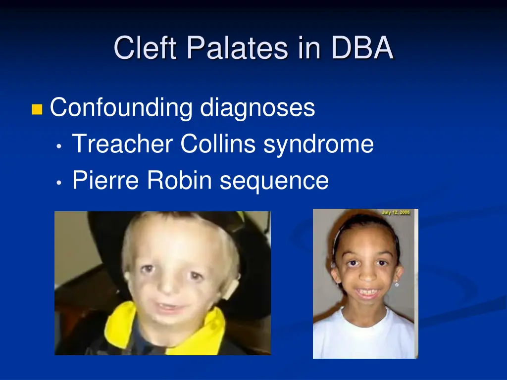 cleft palates in dba