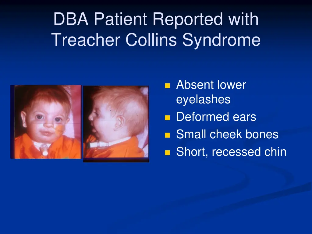dba patient reported with treacher collins