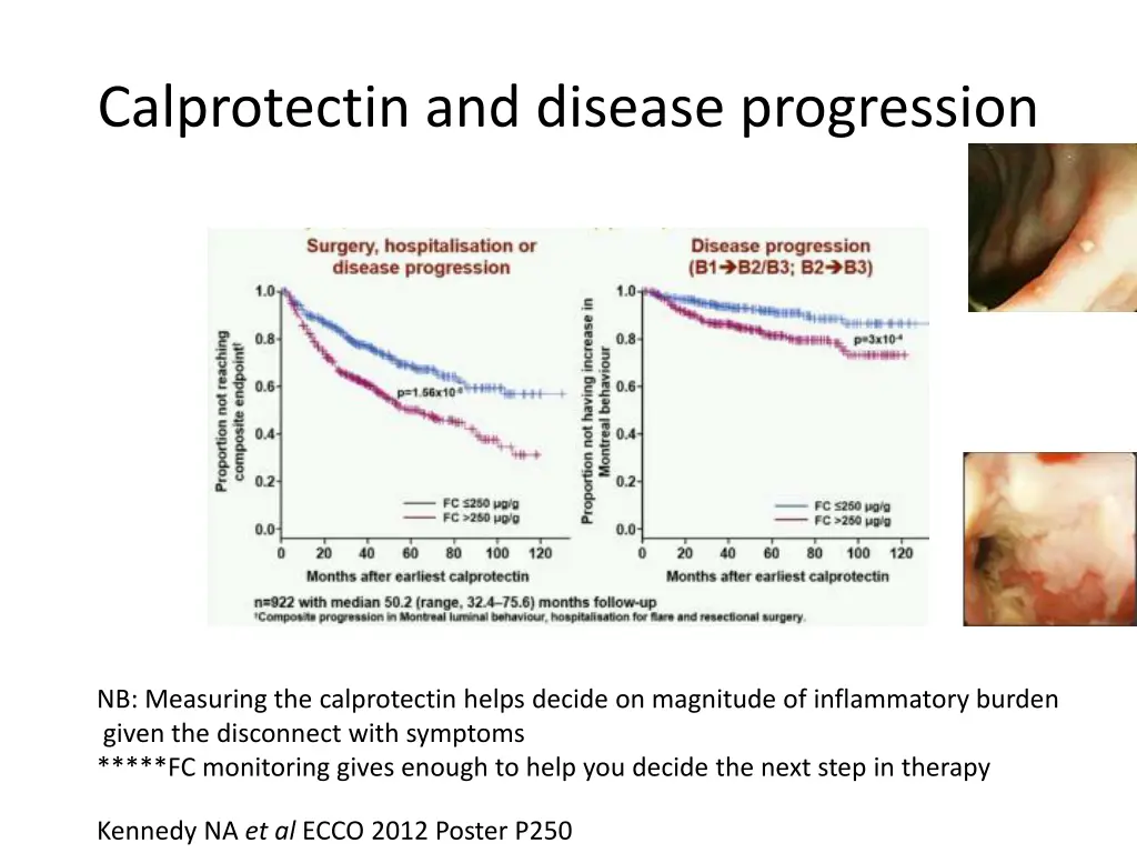 calprotectin and disease progression