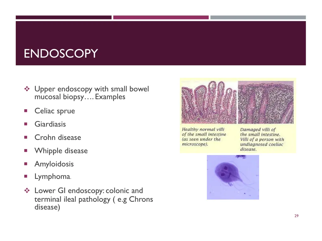 endoscopy