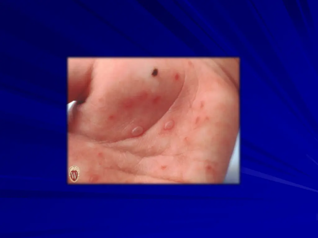 slide15