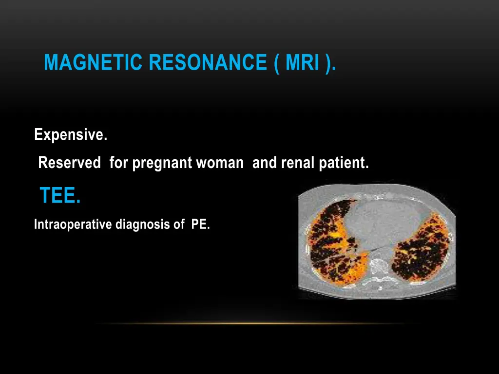 magnetic resonance mri