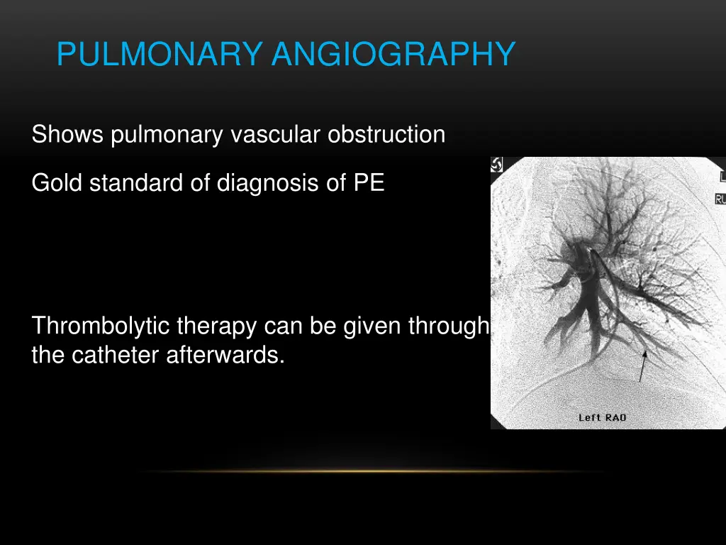 pulmonary angiography