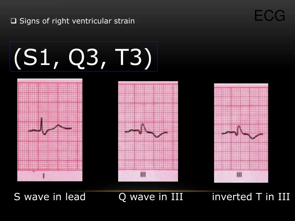slide25