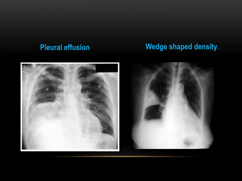 wedge shaped density