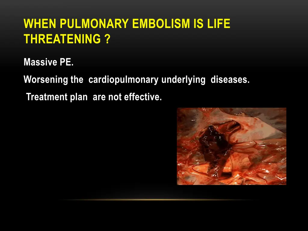when pulmonary embolism is life threatening
