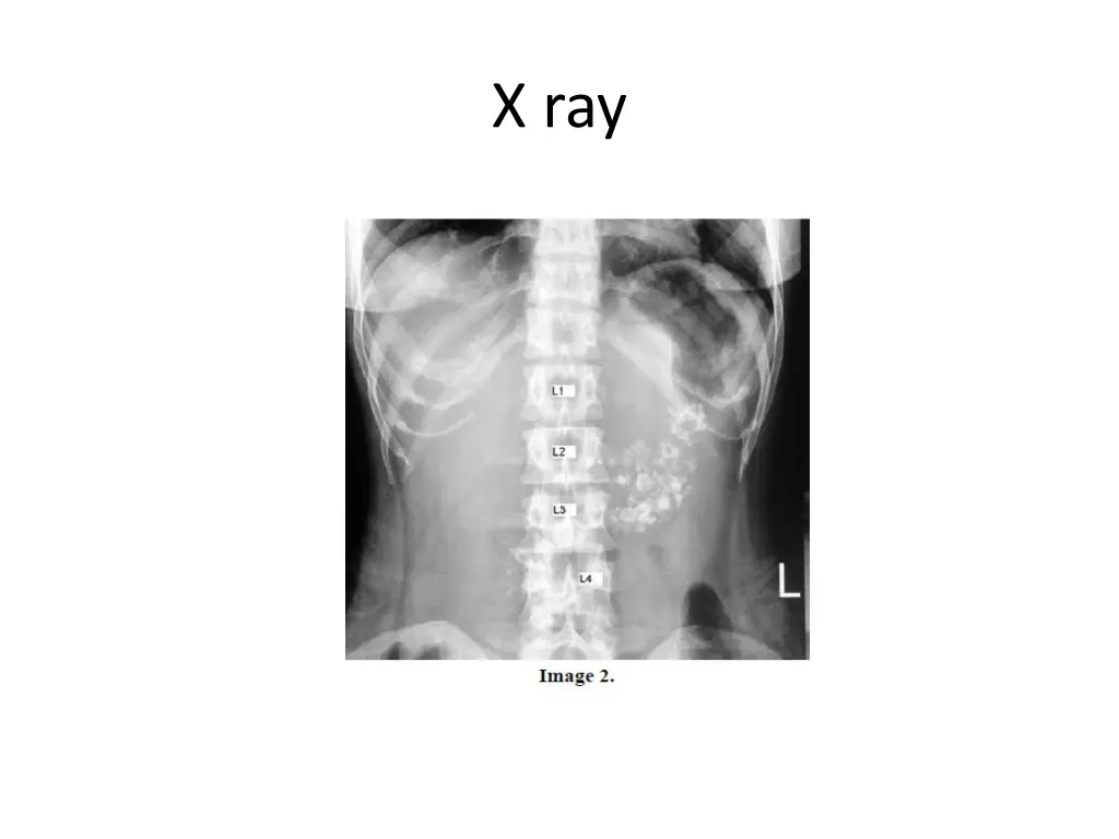 x ray