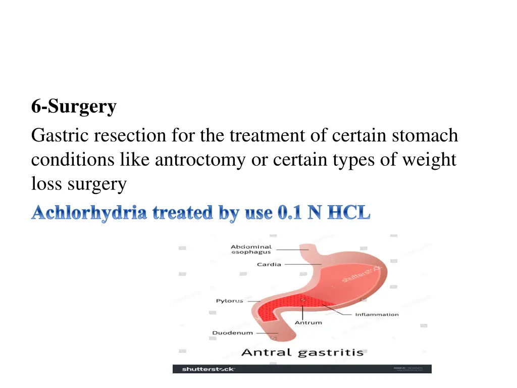 6 surgery gastric resection for the treatment