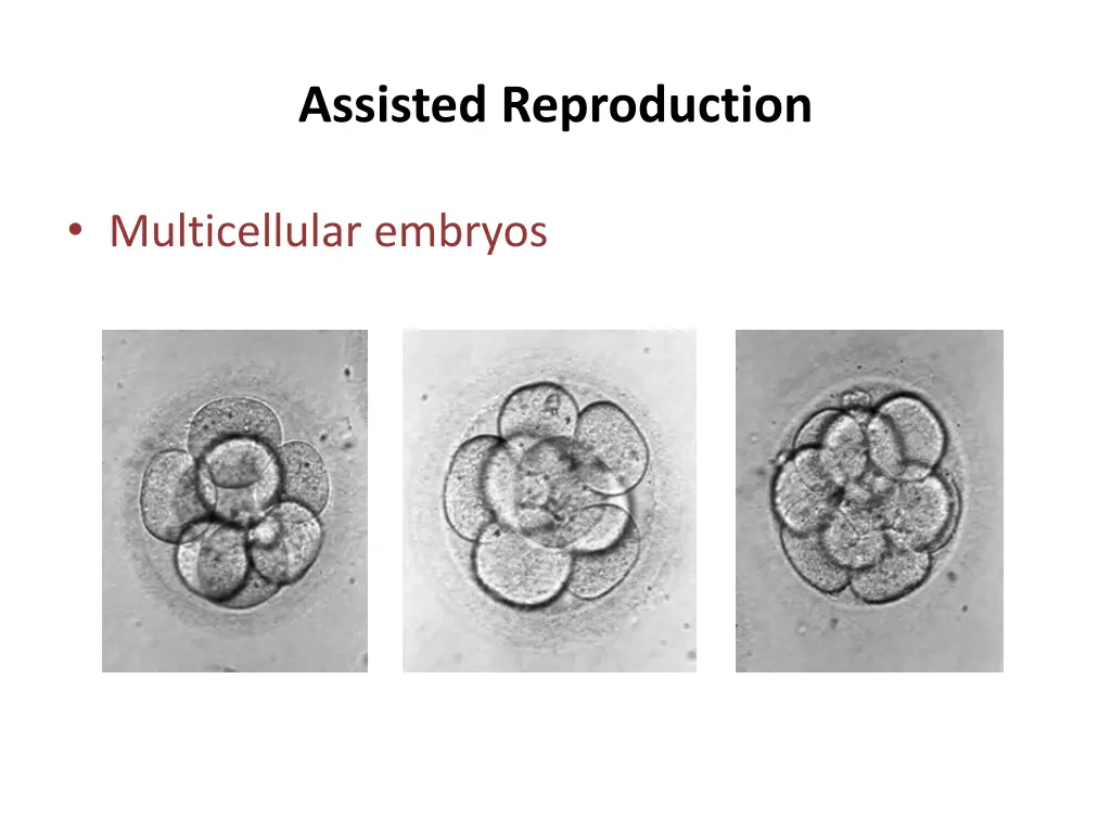 assisted reproduction 4