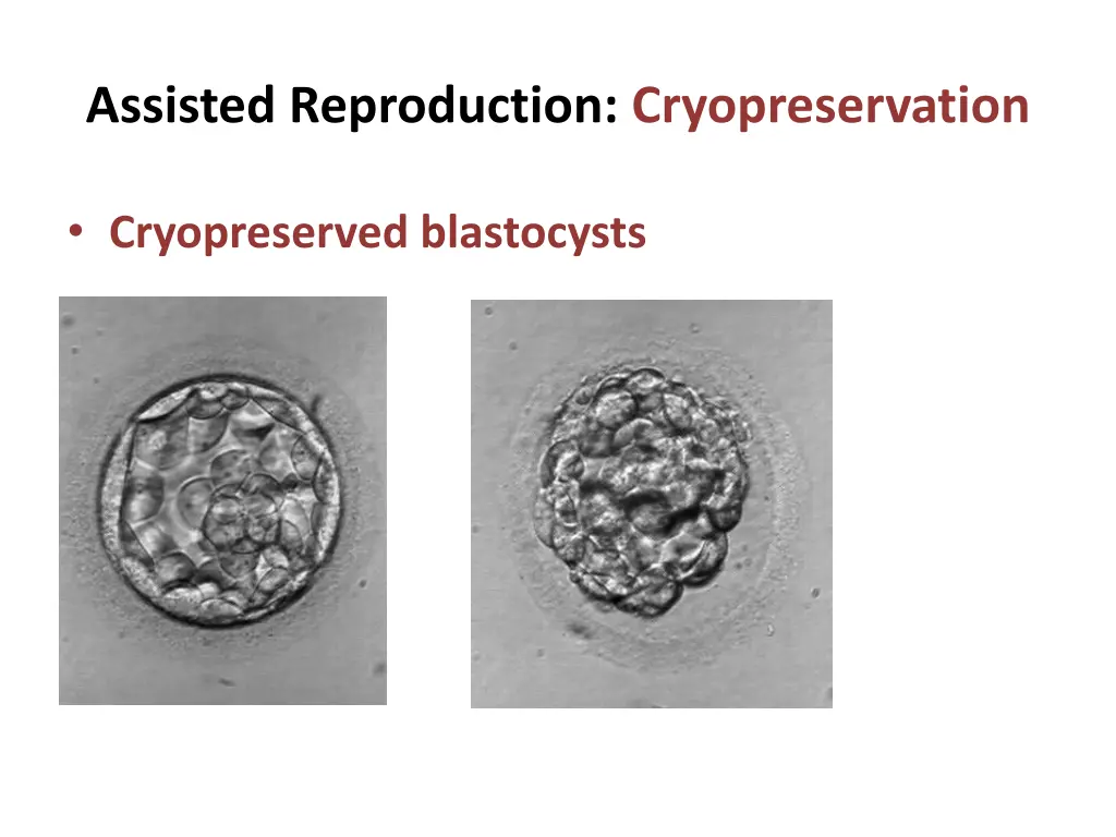 assisted reproduction cryopreservation 2