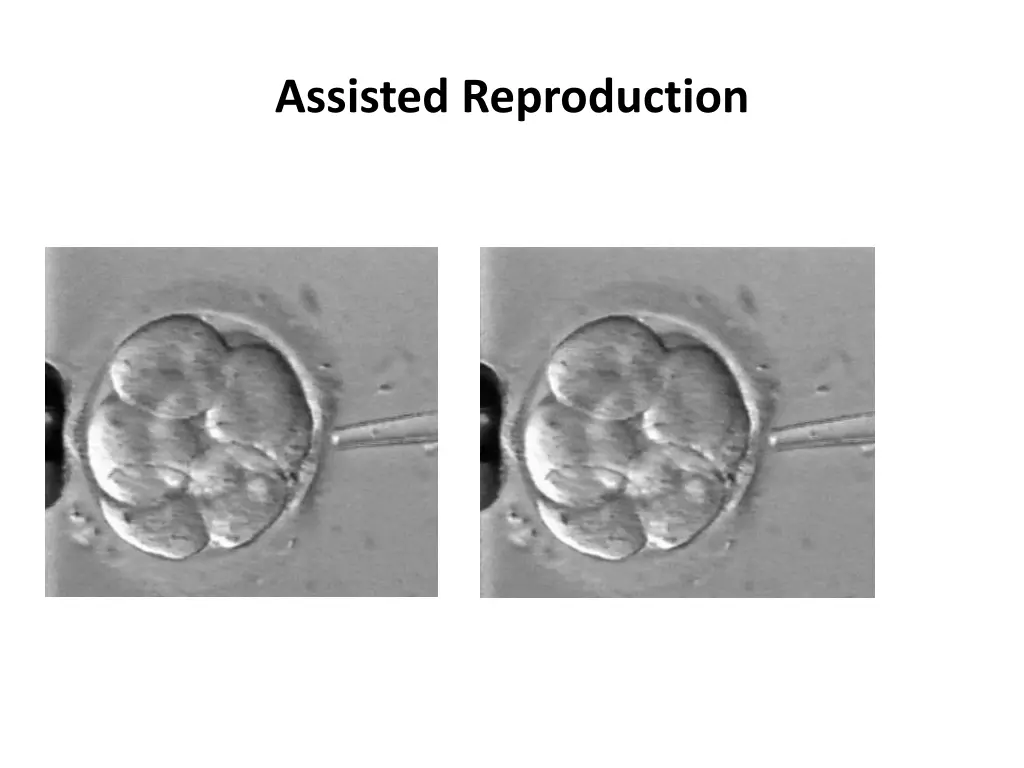 assisted reproduction