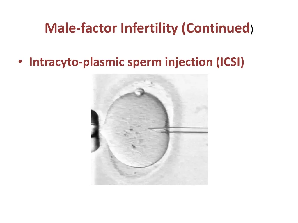 male factor infertility continued