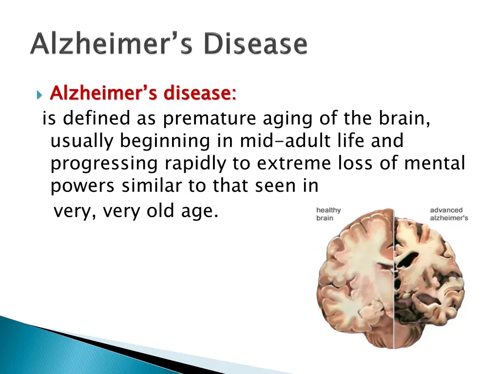 alzheimer s disease is defined as premature aging