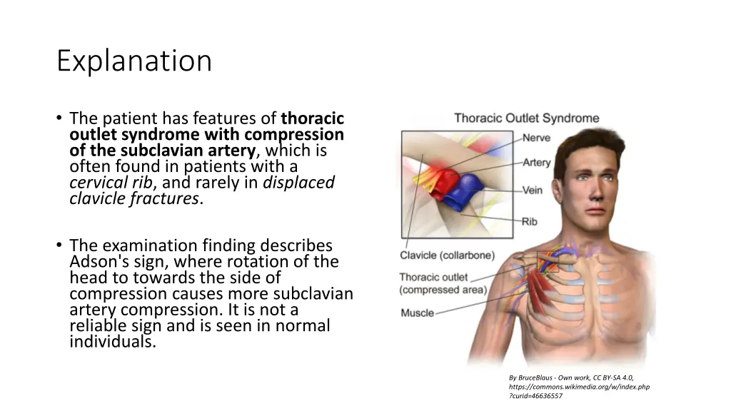 explanation
