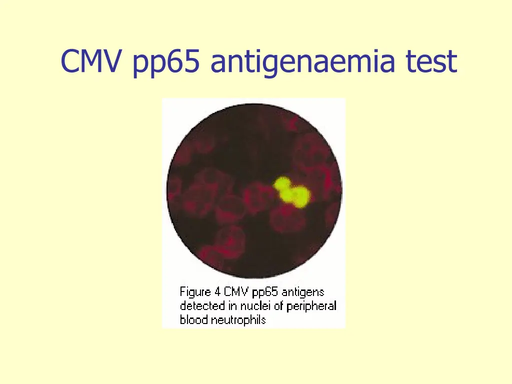 cmv pp65 antigenaemia test