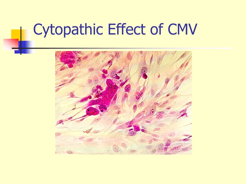 cytopathic effect of cmv