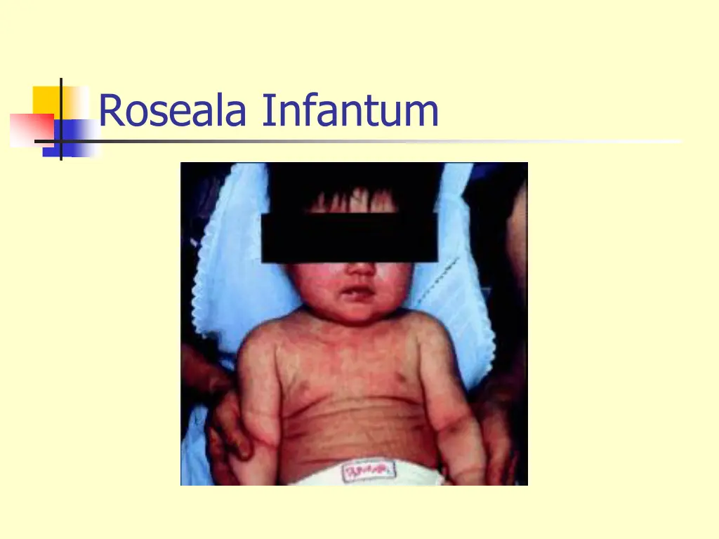 roseala infantum