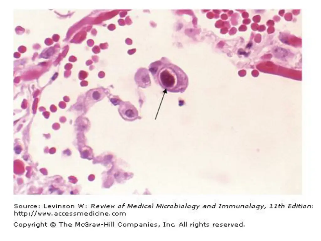 slide18