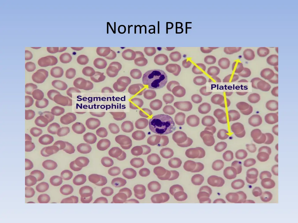 normal pbf