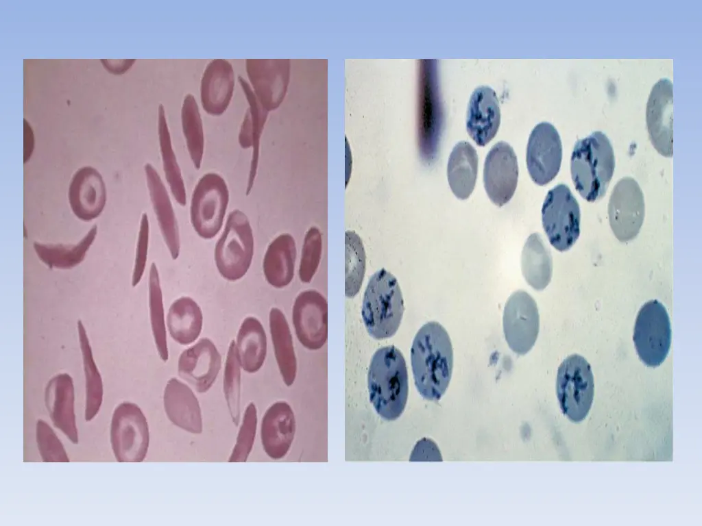 slide13