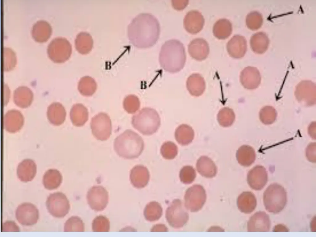 slide20
