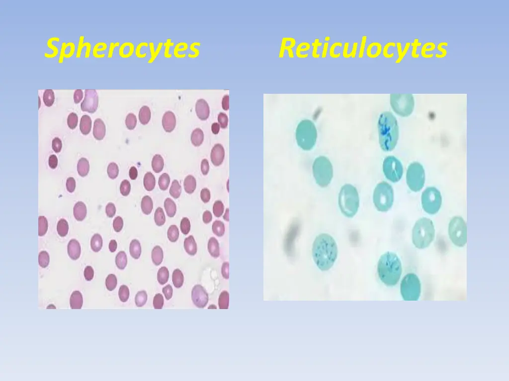spherocytes