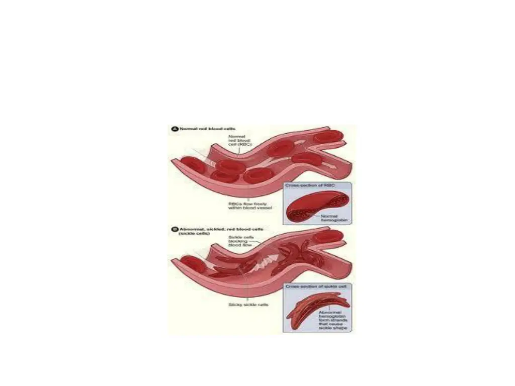 slide13