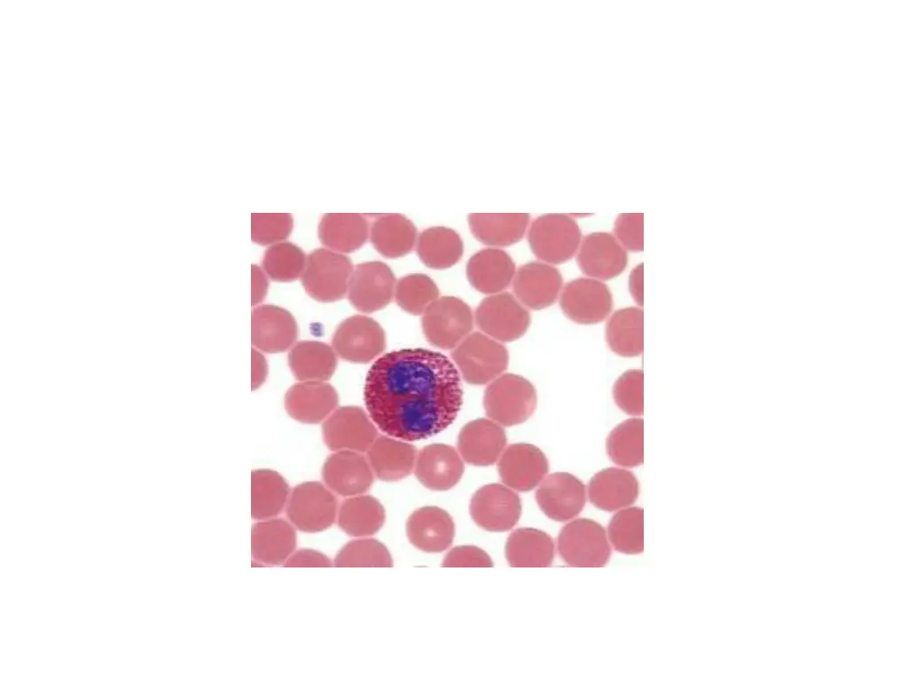 slide22
