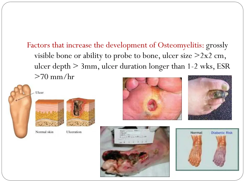 factors that increase the development