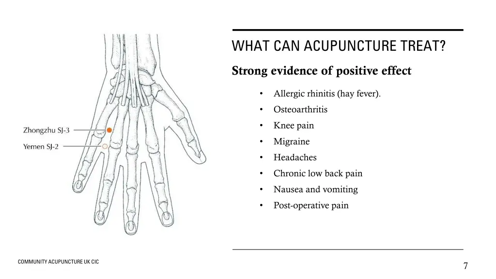 what can acupuncture treat 1