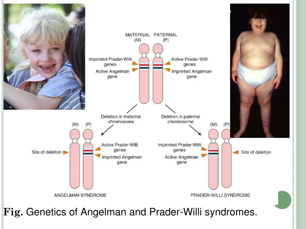 fig genetics of angelman and prader willi