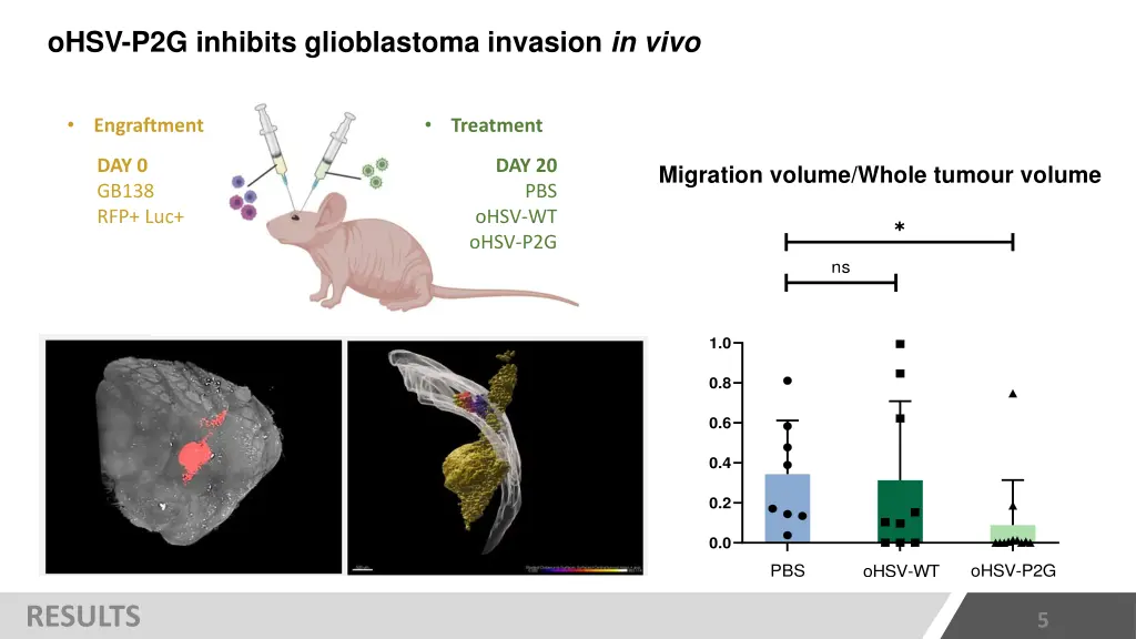 ohsv p2g inhibits glioblastoma invasion in vivo