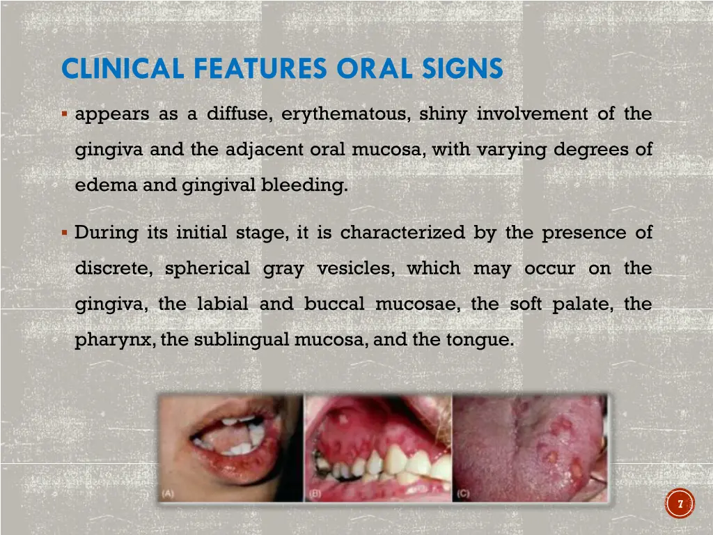 clinical features oral signs