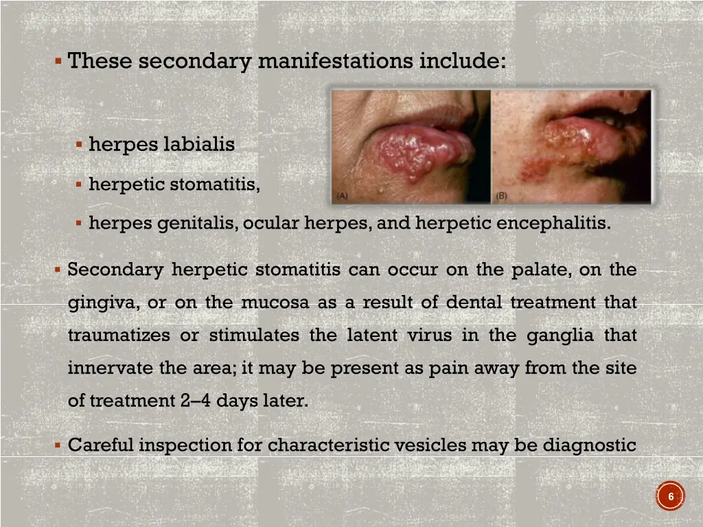 these secondary manifestations include