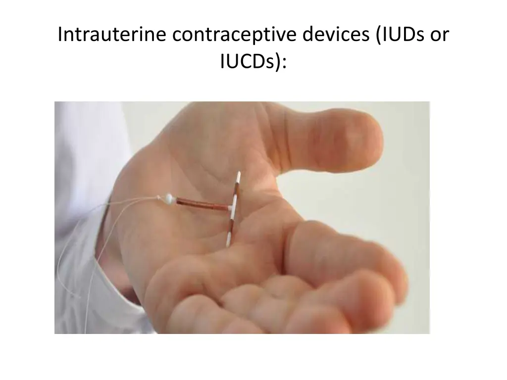 intrauterine contraceptive devices iuds or iucds