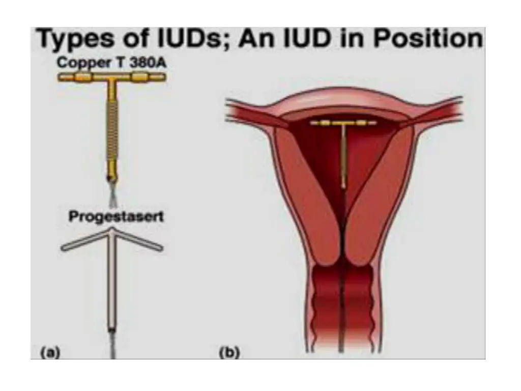 slide48
